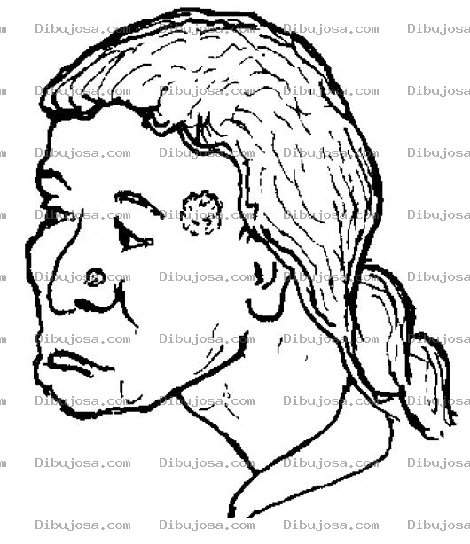 Dibujo para colorear Mujer Con Herpes En La Cara Para Colorear