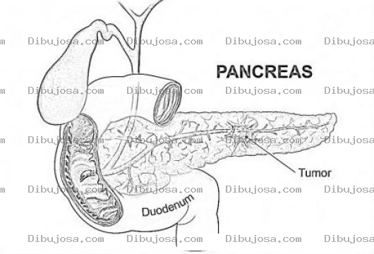 Dibujo para colorear Pancreatic Cancer Printable Coloring Page Cancer De Pancreas Para Colorear E Imprimir
