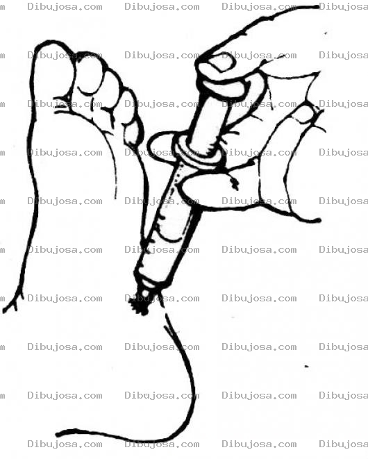 Dibujo para colorear Dibujo De Inyeccion En El Pie Para Pintar Y Colorear Pie Inyectado Con Anestesia