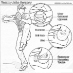 Dibujo para colorear Tommy John Surgery Lamina Informativa De La Cirugia De Tommy John Para Pintar Y Colorear