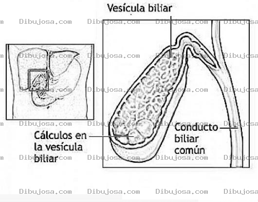 Dibujo para colorear Calculos En La Vesicula Biliar Dibujo Para Ver La Ubicacion De La Vesicula Y Ver Las Piedras De La Besicula Viliar Que Segrega La Bilis Para Pintar Y Colorear