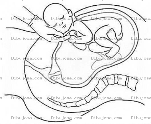 Dibujo para colorear Parto Por Cesarea En Hospital Dibujo De Operacion De Un Parto Por Cesarea Del Nacimiendo De Un Bebe Para Pintar Y Colorear