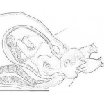 Dibujo para colorear Parto Normal Dibujo Del Nacimiento De Un Bebe Por La Via Normal Sin Complicaciones Sin Cesarea y sin Anestesia General Para Pintar Y Colorear