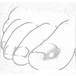 Dibujo para colorear Dibujo De Una Encarnada Para Pintar Y Colorear Unaencarnada En El Dedo Gordo Del Pie