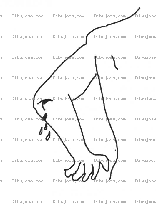 Dibujo para colorear Herida En El Codo Por Caida Para Pintar Y Colorear Codo Abierto Que Necesita 3 Puntos Antibiotico De Amoxicilina Y Diclofenaco 2 Veces Al Dia Durante 7 Dias