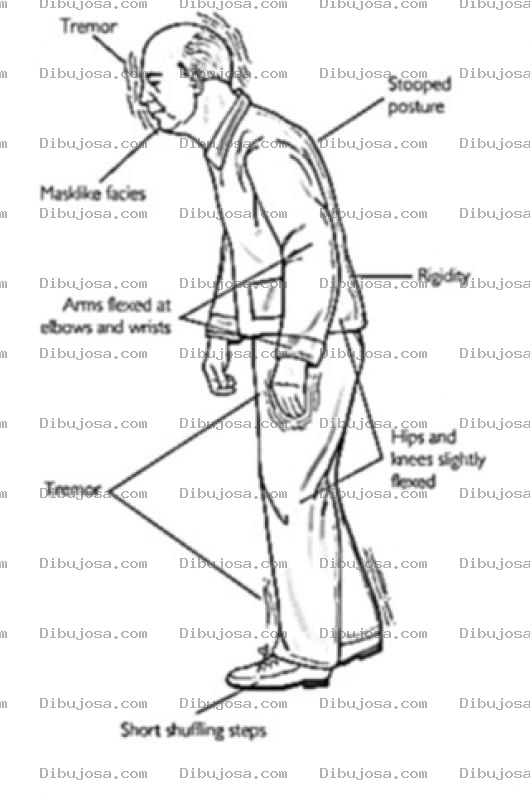Dibujo para colorear Dementia Symptoms Coloring Page Sintomas De La Demencia Para Colorear